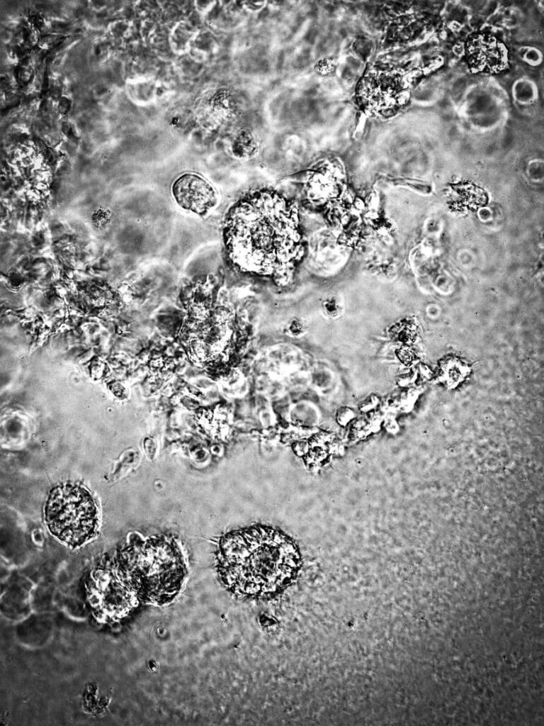 IN LOCO PARENTIS frontpage vertical